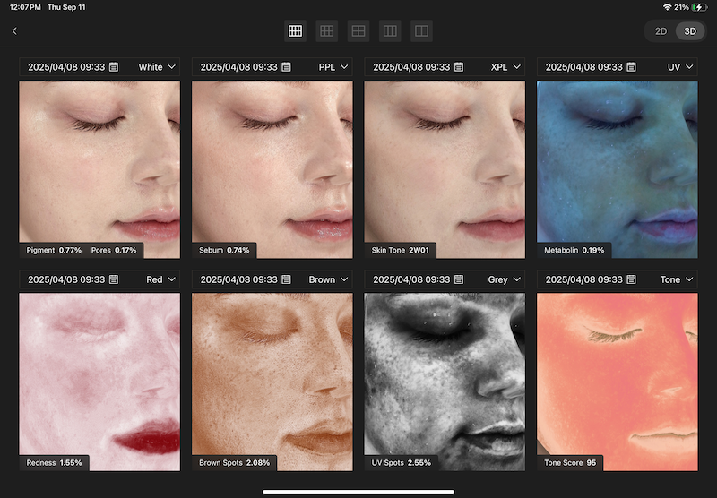 Skin assessment result
