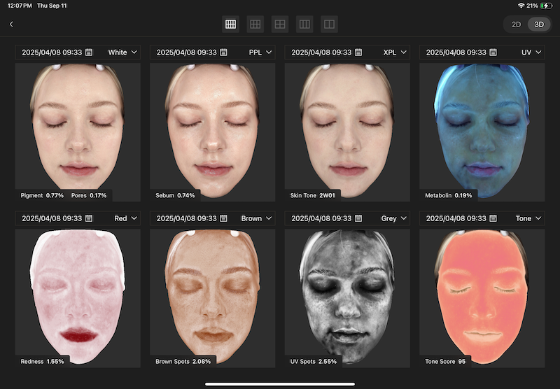 Skin assessment result