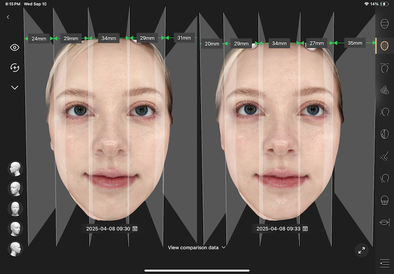 Skin assessment result