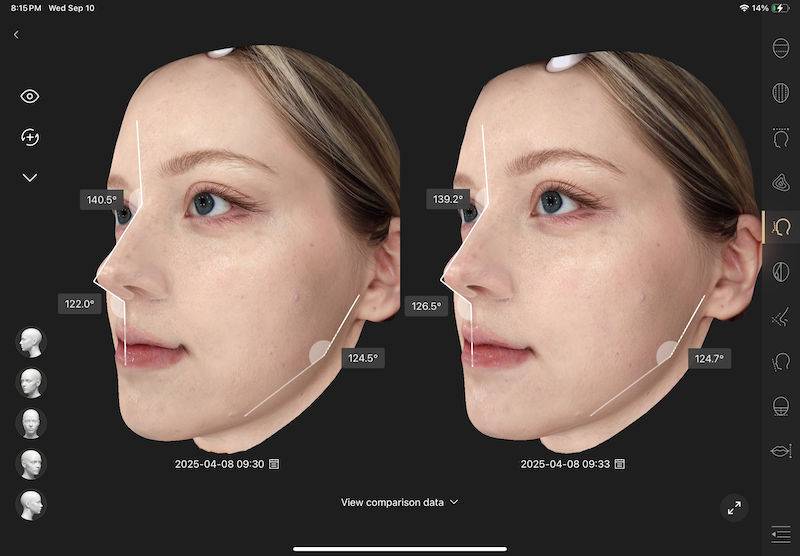 Skin assessment result