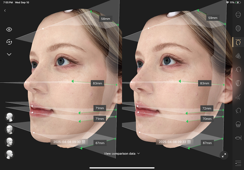 Skin assessment result
