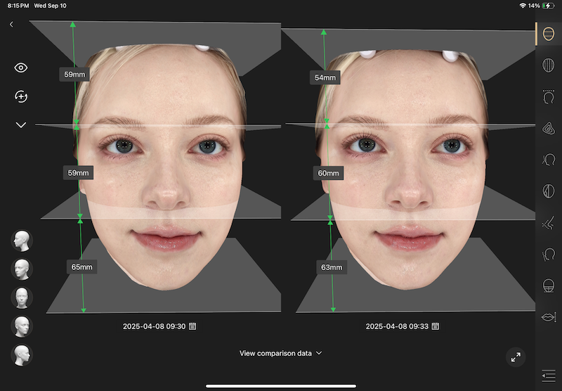 Skin assessment result