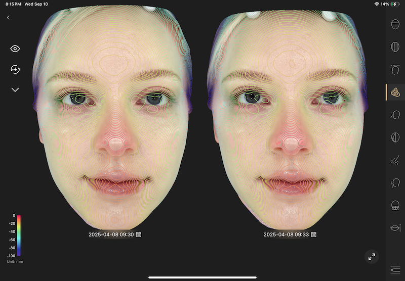 Skin assessment result