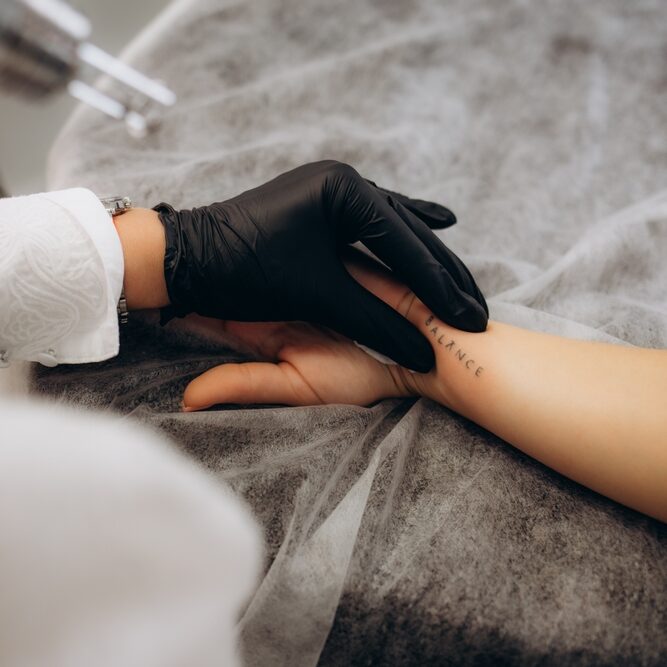 Beautician,Using,Laser,Device,To,Remove,An,Unwanted,Tattoo,From